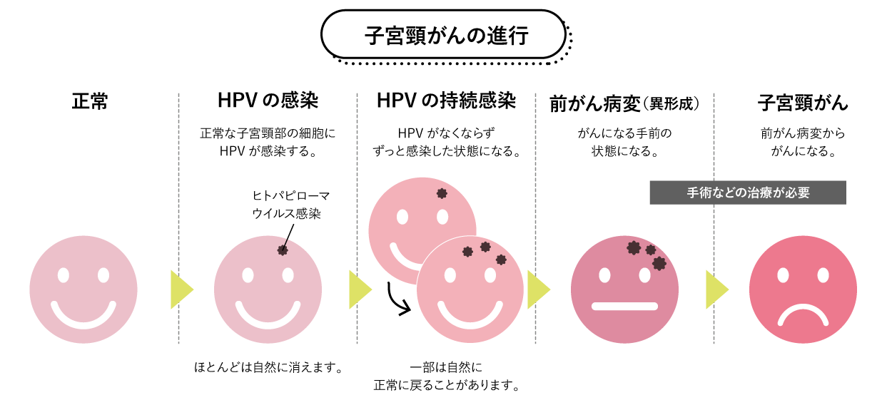 子宮頸がんの進行
